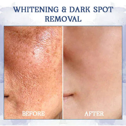 🥥𝐋𝐚𝐬𝐭 𝐃𝐚𝐲 𝐃𝐢𝐬𝐜𝐨𝐮𝐧𝐭: 𝟕5% 𝐎𝐅𝐅🫧 Advanced Fat-Burning & Firming Cream: Remove Excess Fat and Revitalize Skin Elasticity