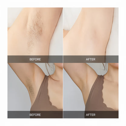 SilkAura™ — Enjoy Effortless, Lasting Smoothness That Boosts Your Confidence Every Day