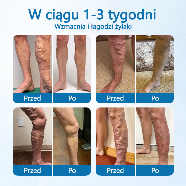 VeinVive™ — Reveal Smooth, Pain-Free Legs That Turn Heads Instantly