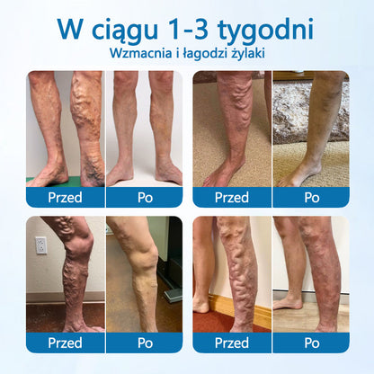 VeinVive™ — Reveal Smooth, Pain-Free Legs That Turn Heads Instantly