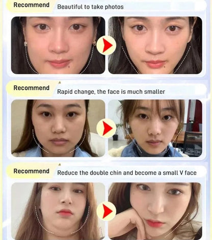 ReShapeSilk™ — Wake Up to a Stunningly Sculpted Jawline Without Surgery or Strain