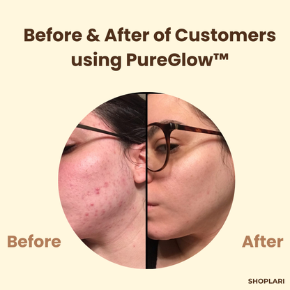 1+1 Free | PureGlow Black Tea Mask™ Minimizes Wrinkles and Fine Lines for Youthful Skin