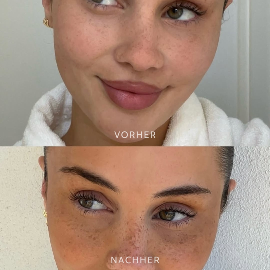 FrecklEase™ — Unlock Your Effortless, Sun-Kissed Confidence Instantly