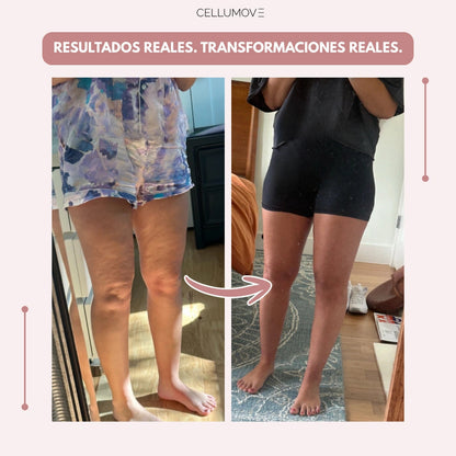 VitaStride™ — Feel Energized Legs and Say Goodbye to Swelling All Day