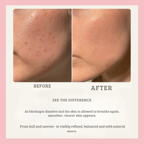 PoreVanta™ — Reveal Radiant Skin by Deeply Clearing Pores for a Glow You’ll Adore