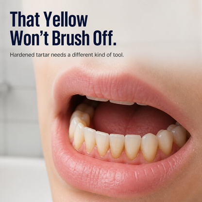 DentaVibe™ — Effortlessly Shatter Stubborn Tartar for a Radiant, Confident Smile