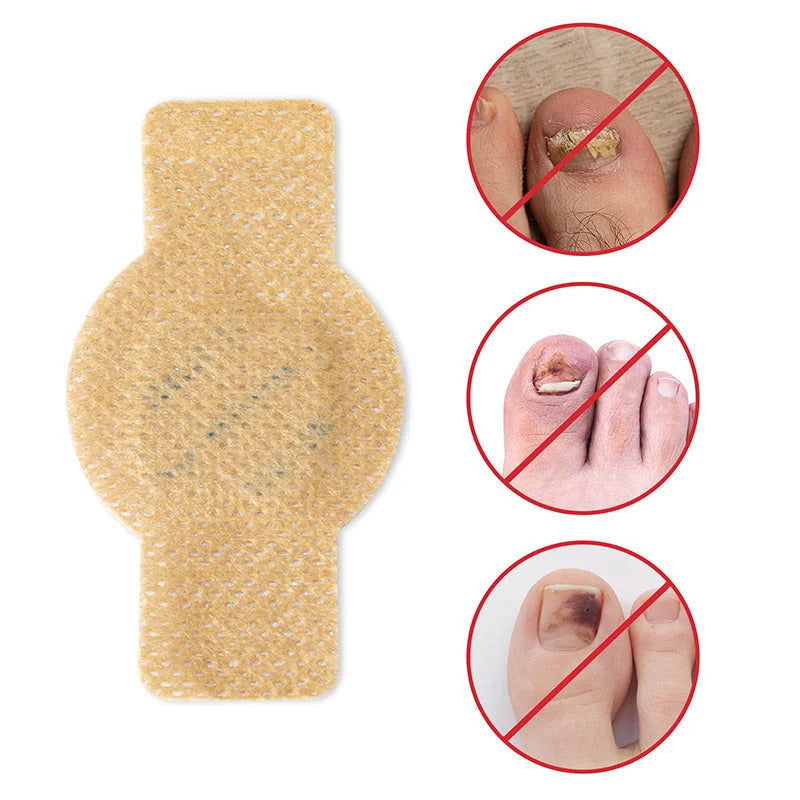 ClearCure™ Nail Patches — Restore Gorgeous, Confident Nails Without the Embarrassment