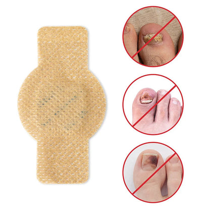 ClearCure™ Nail Patches — Restore Gorgeous, Confident Nails Without the Embarrassment