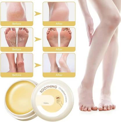VelvetTouch™ — Heal Dry, Cracked Skin Instantly for Silky, Touchable Smoothness