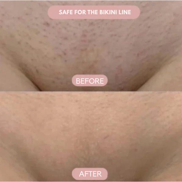 SilkSleek™ — Glide to Gorgeous Skin Without a Single Cut or Irritation