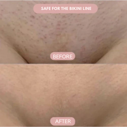 SilkSleek™ — Glide to Gorgeous Skin Without a Single Cut or Irritation