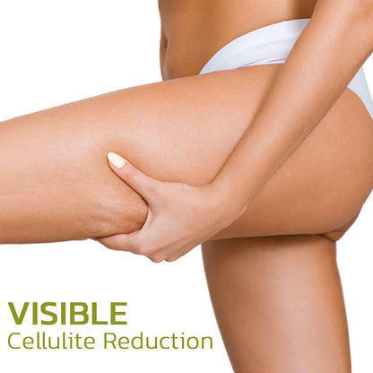 CelluSmooth™ Solution for Cellulite Reduction