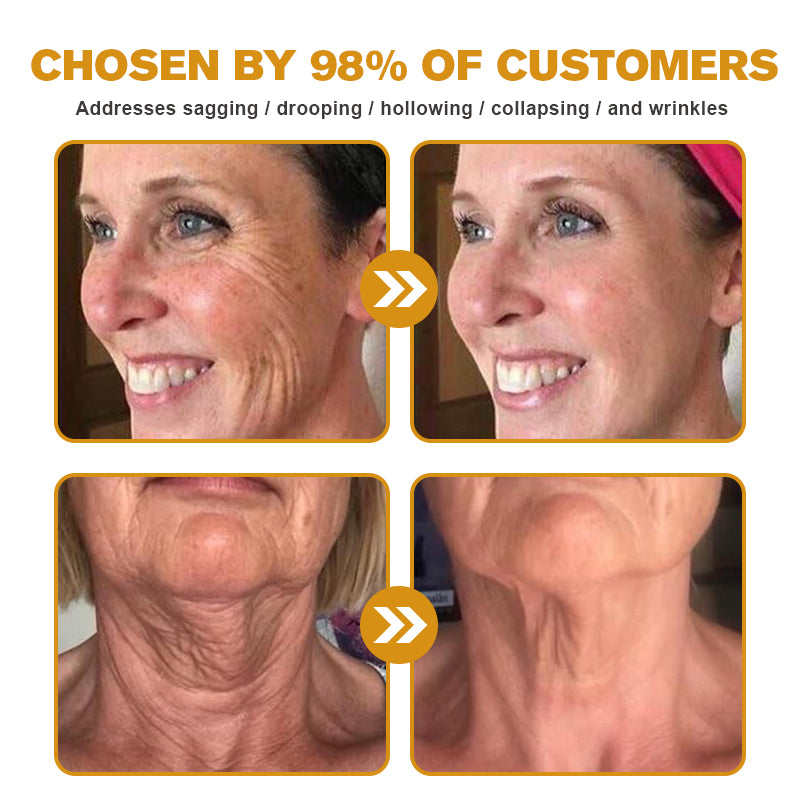 Furzero™ — Erase Wrinkles, Reveal Youthful Skin | 50% Off
