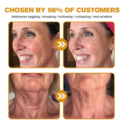Furzero™ — Erase Wrinkles, Reveal Youthful Skin | 50% Off