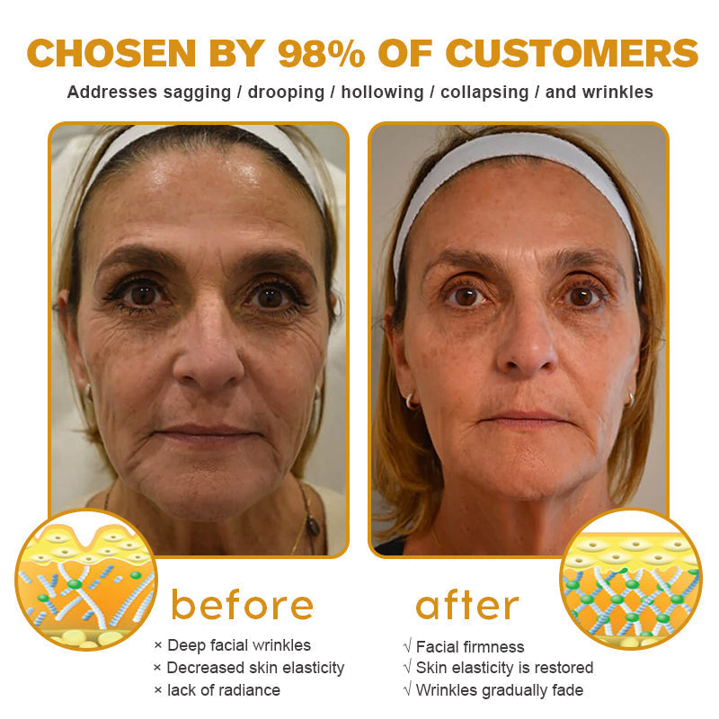 Furzero™ — Erase Wrinkles, Reveal Youthful Skin | 50% Off