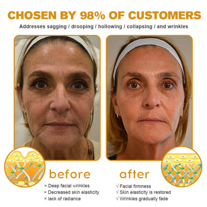 Furzero™ — Erase Wrinkles, Reveal Youthful Skin | 50% Off