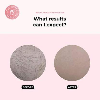 Lynx™ — Pain-Free Smooth Skin, Anytime | 50% Off