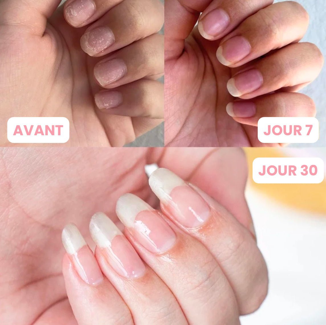 Pure Nail Serum | Almalys Nail Serum